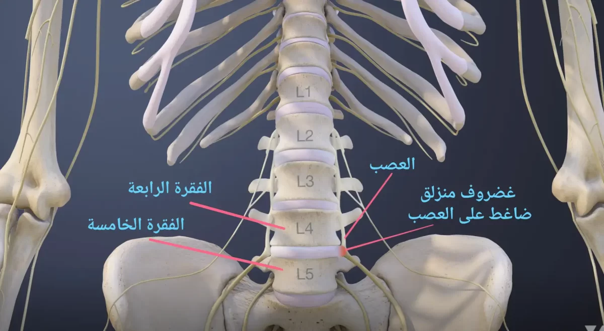 أين تقع الفقرة الرابعة والخامسة بالصور - الفقرات القطنية